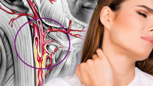 Şah damar hastalığının ameliyatsız tedavisi mümkün