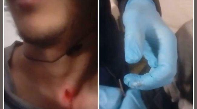 Plastik mermiye saplanması için tel yerleştirildiği iddiası