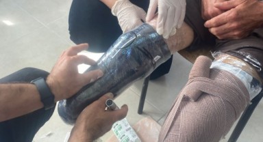 Ampute depremzedeye protez bacaklar yapıldı