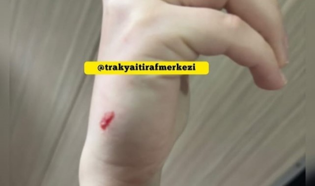 Kız öğrenciye darp iddiası