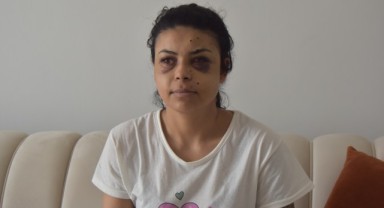 Kavgada tüfekten çıkan saçmalarla gözünden yaralandı