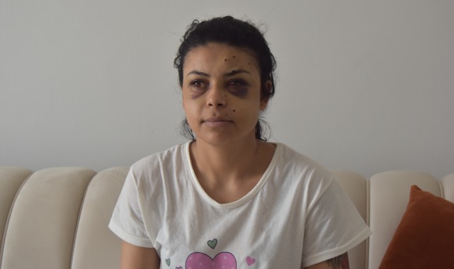 Kavgada tüfekten çıkan saçmalarla gözünden yaralandı